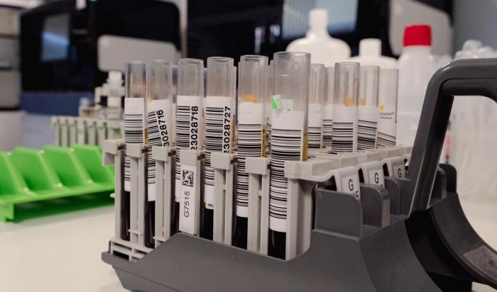 Image 1 of article El Banco de Sangre de Aragón exporta su sistema de gestión por su innovación y eficiencia