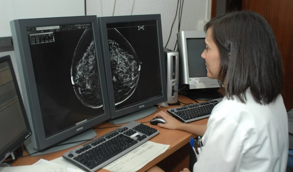 Imagen del artículo Más de 387.000 mujeres han participado en el cribado de cáncer de mama de enero a octubre