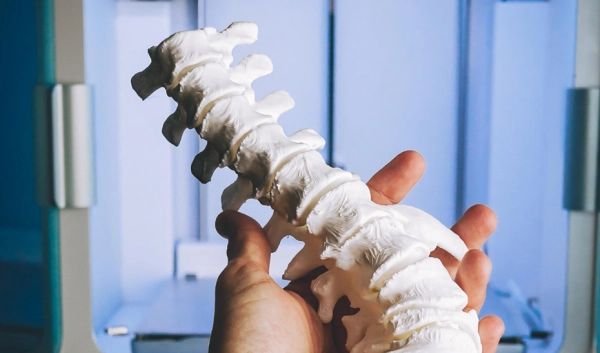 Imagen del artículo Investigadores andaluces logran huesos artificiales en 3D con materiales sostenibles para planificar operaciones quirúrgicas más eficientes