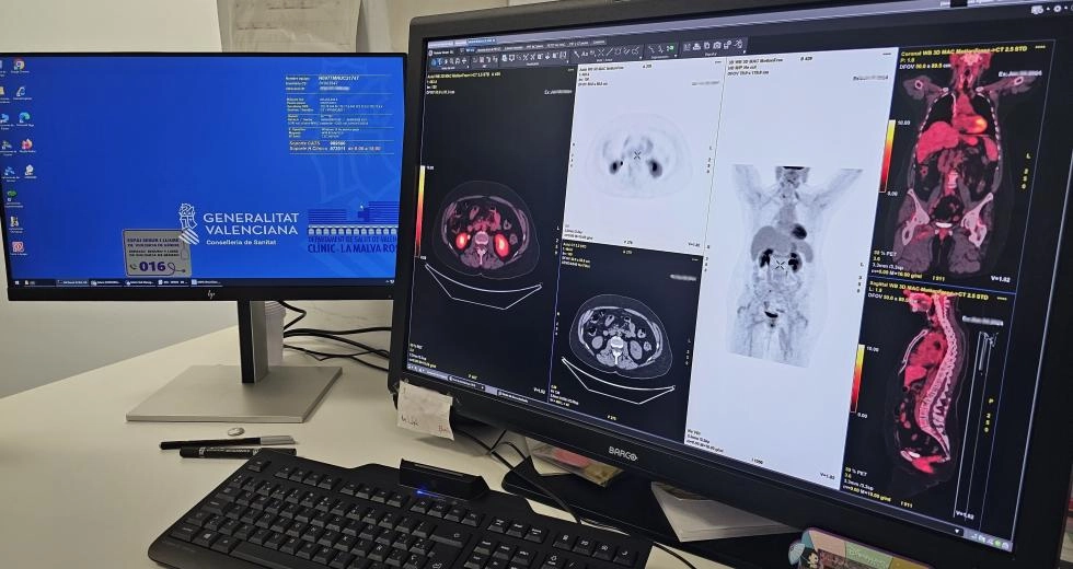 Imagen del artículo El Hospital Clínico licita la adquisición de diez estaciones de trabajo para la lectura de pruebas radiológicas