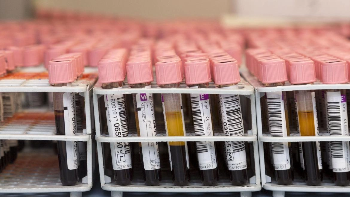 Imagen del artículo El macromaratón Madrid Dona Sangre alcanza las 5.725 donaciones en una semana