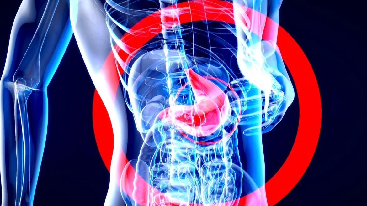 Imagen del artículo El Servicio de Digestivo del Hospital de La Princesa participa en un proyecto internacional de detección de lesiones previas al cáncer gástrico