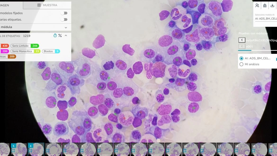 Imagen del artículo El Hospital 12 de Octubre coordina un proyecto de Inteligencia Artificial para el tratamiento y pronóstico de enfermedades hematológicas